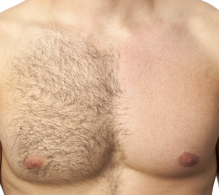 Epilare Bucuresti | Salon Epilare Definitiva Laser Bucuresti | Epilare cu laser Bucuresti | Perfect Skin Laser Bucuresti | Salon de epilare cu laser Bucuresti | Epilare Definitiva Bucuresti