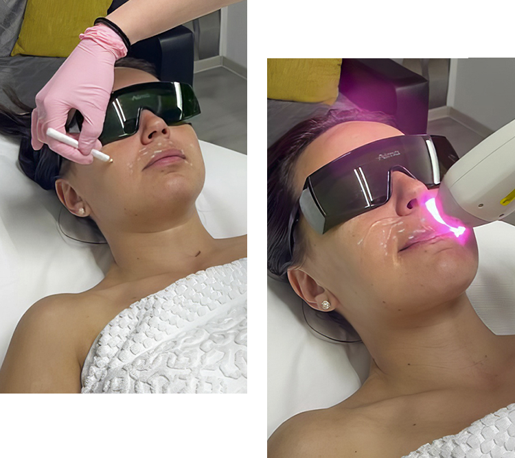 Epilare Bucuresti | Salon Epilare Definitiva Laser Bucuresti | Epilare cu laser Bucuresti | Perfect Skin Laser Bucuresti | Salon de epilare cu laser Bucuresti | Epilare Definitiva Bucuresti